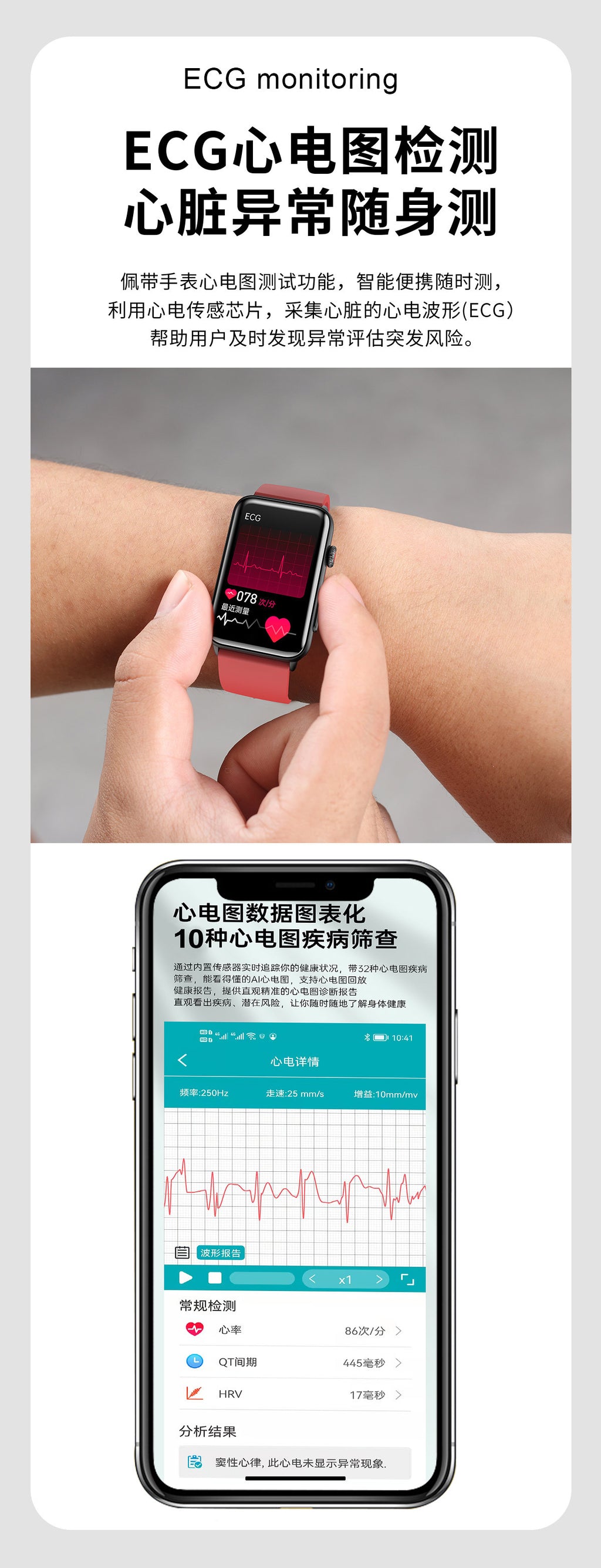 Hot Sale et620Bluetooth Call Watch Uric Acid Blood Lipid Blood Sugar Monitoring Body Temperature Blood Pressure Measurement Smart Watch