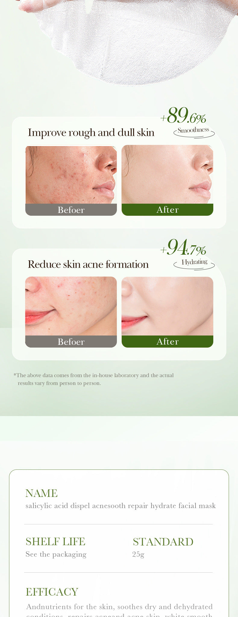 Full English Salicylic Acid Mask SADOER Anti-acne Soothing Skin Rejuvenation Hydrating Anti-acne Mask  Wholesale