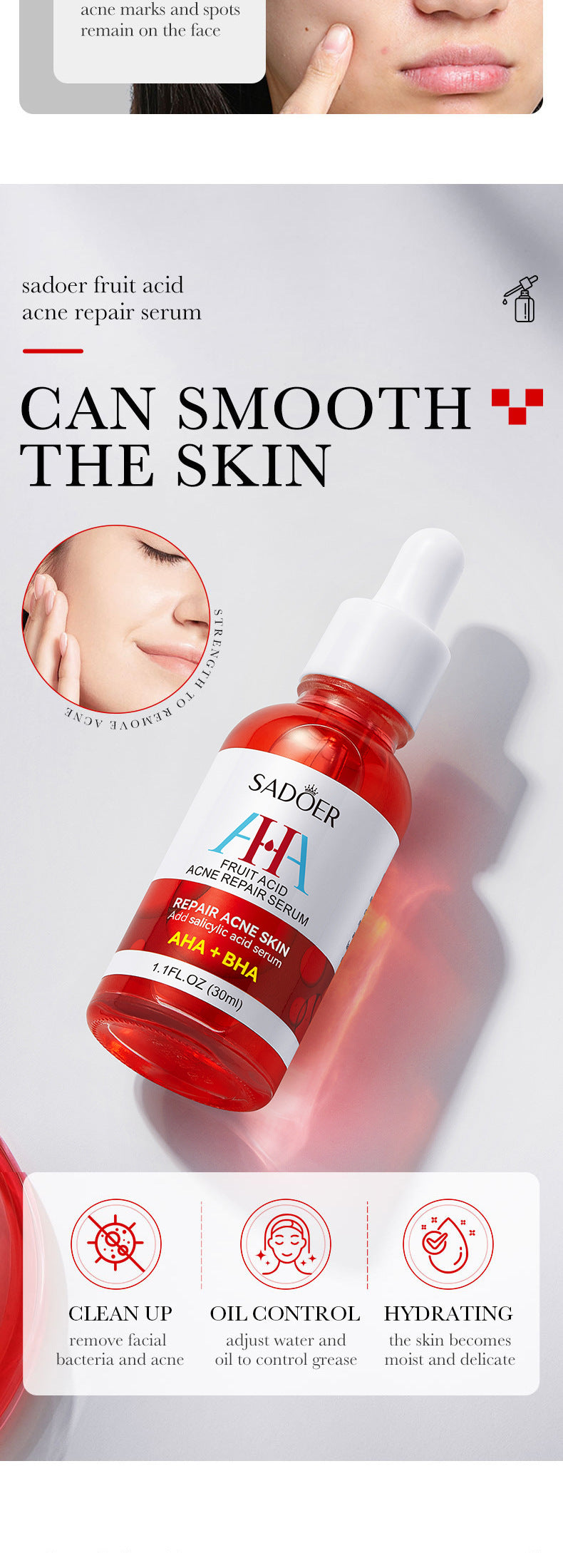 Anti-acne Serum SADOER Fruit Acid Fades Acne Marks, Hydrates and Moisturizes, Cross-Border Wholesale