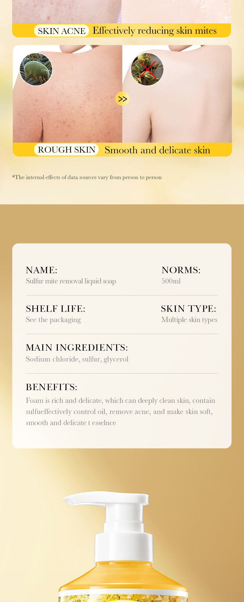 Full English Sulfur Mite Removal Body Wash SADOER Clean body hydrating moisturizing body wash  wholesale