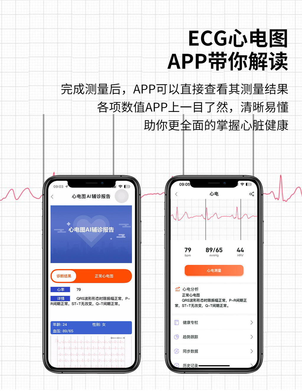 S22Air Pump Type Precision Blood Pressure Smart Watch ecg ECG Health Monitoring Blood Pressure Health Smart Watch