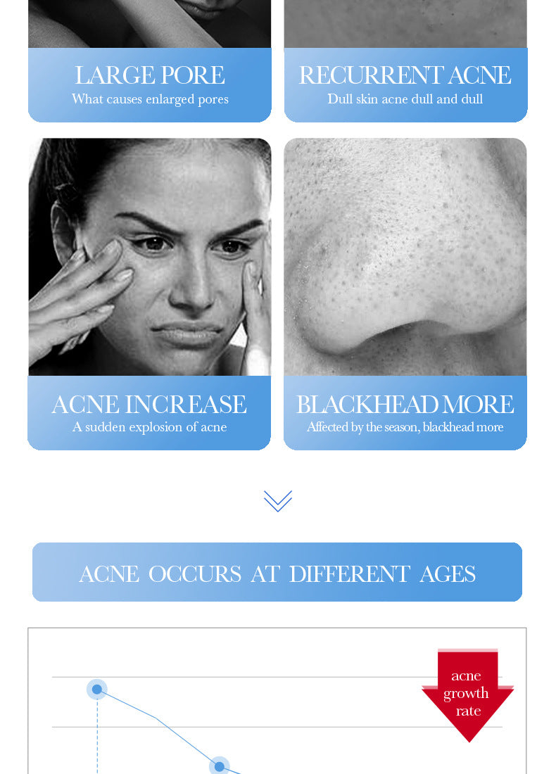 Full English Cream BIOAOUA Salicylic Acid Moisturizing Hydrating Fading Acne Marks  Wholesale