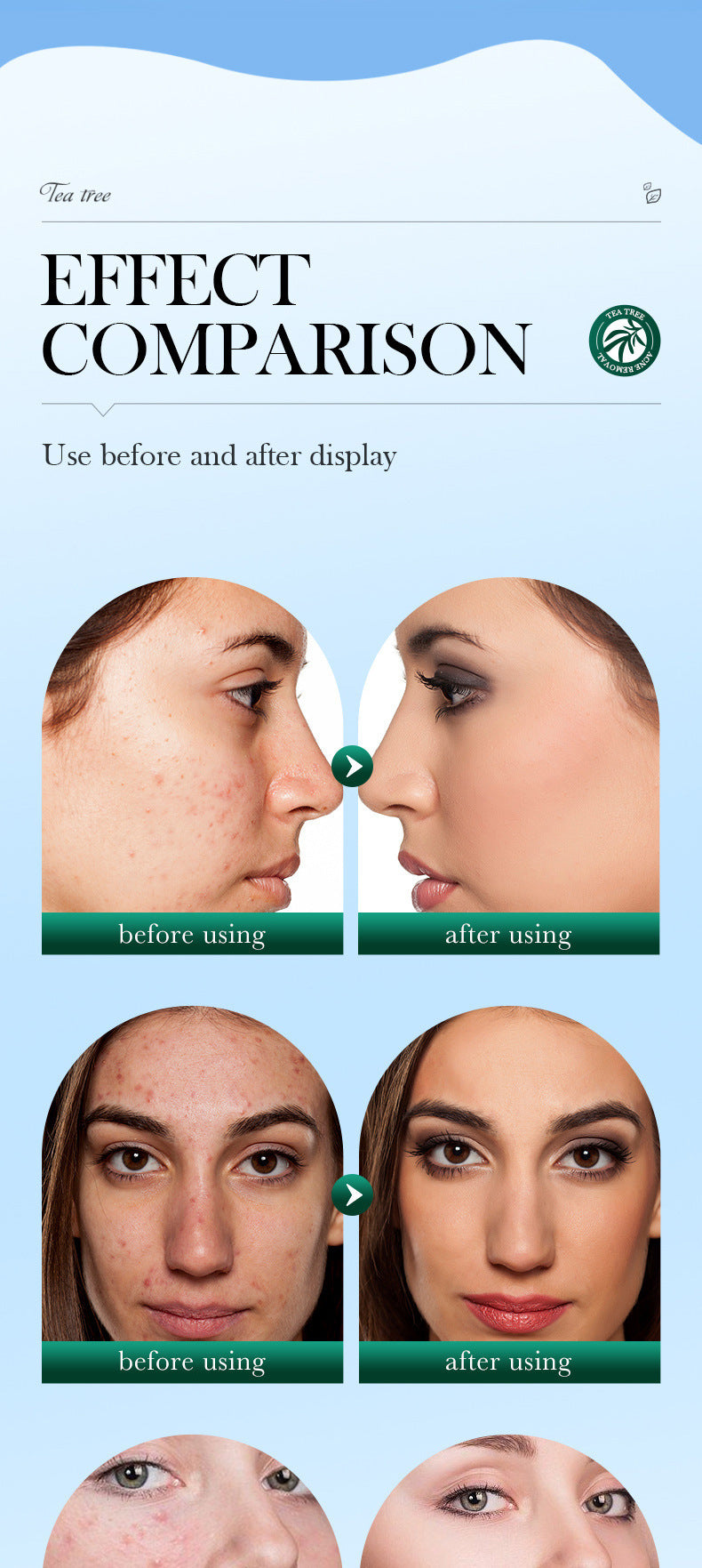 Full English Tea Tree Facial Cleanser100gSADOER Deep Cleansing Moisturizing Refreshing Cleanser  Wholesale