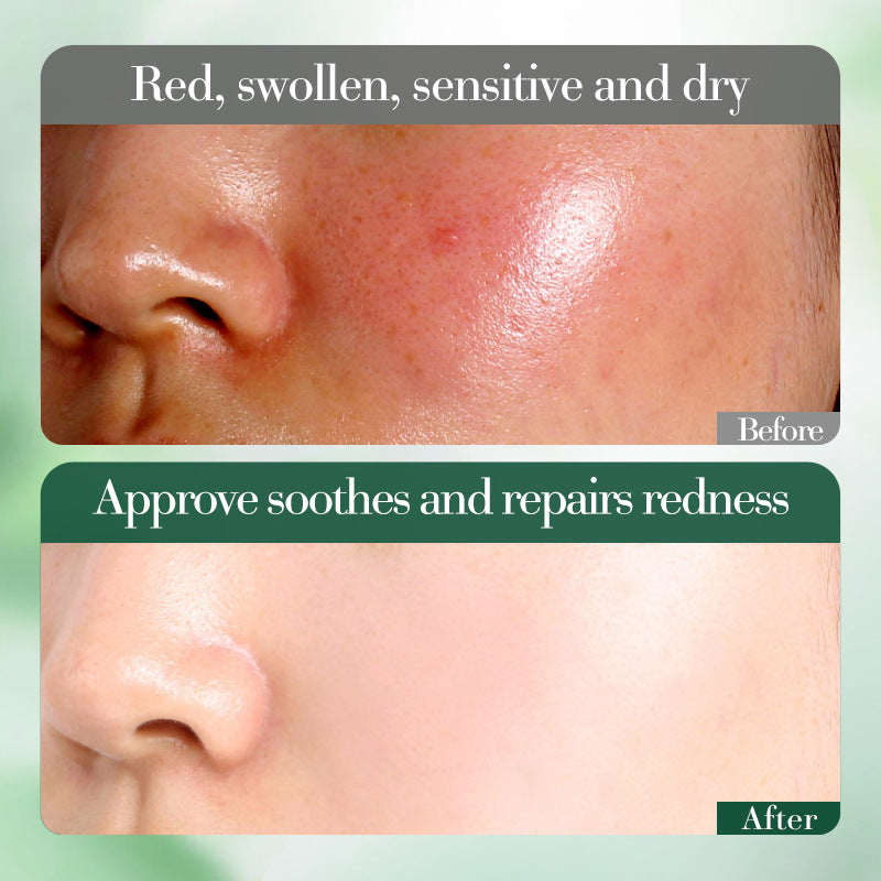 Centella Asiatica Moisturizing Essence FAYANKOU Soothing and rejuvenating serum cross-border wholesale