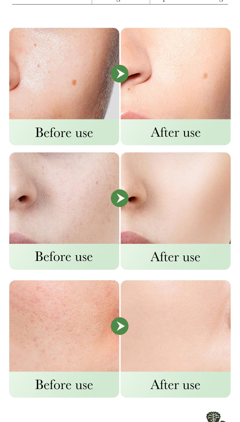 Centella Asiatica Skin Care Set in English BIOAOUA Cleansing, moisturizing and moisturizing six-piece set  foreign trade wholesale