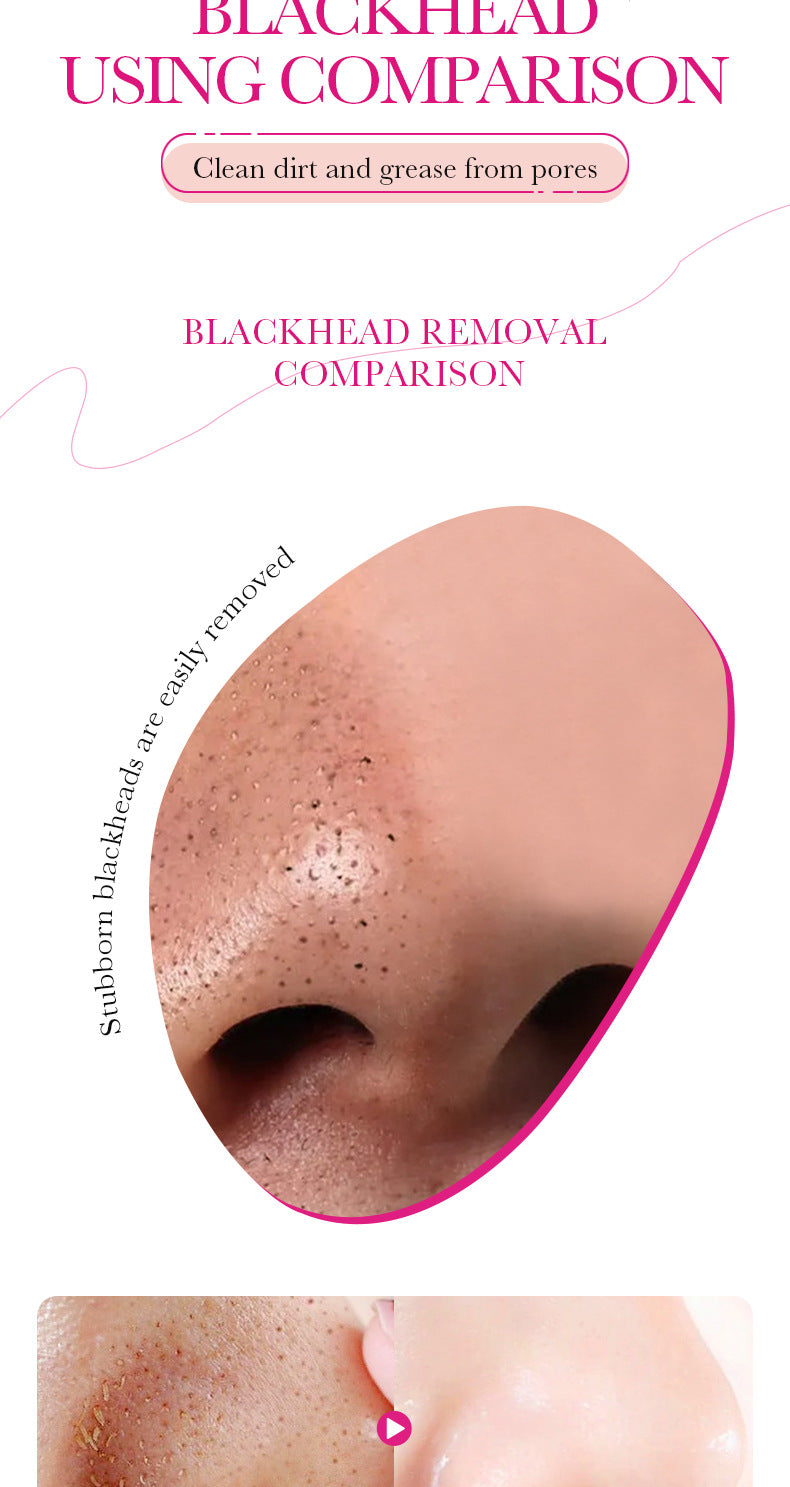 Full English Bamboo Charcoal Women's Nose Strips SADOER Deep Cleansing Blackhead Removal Nose Strips  Wholesale