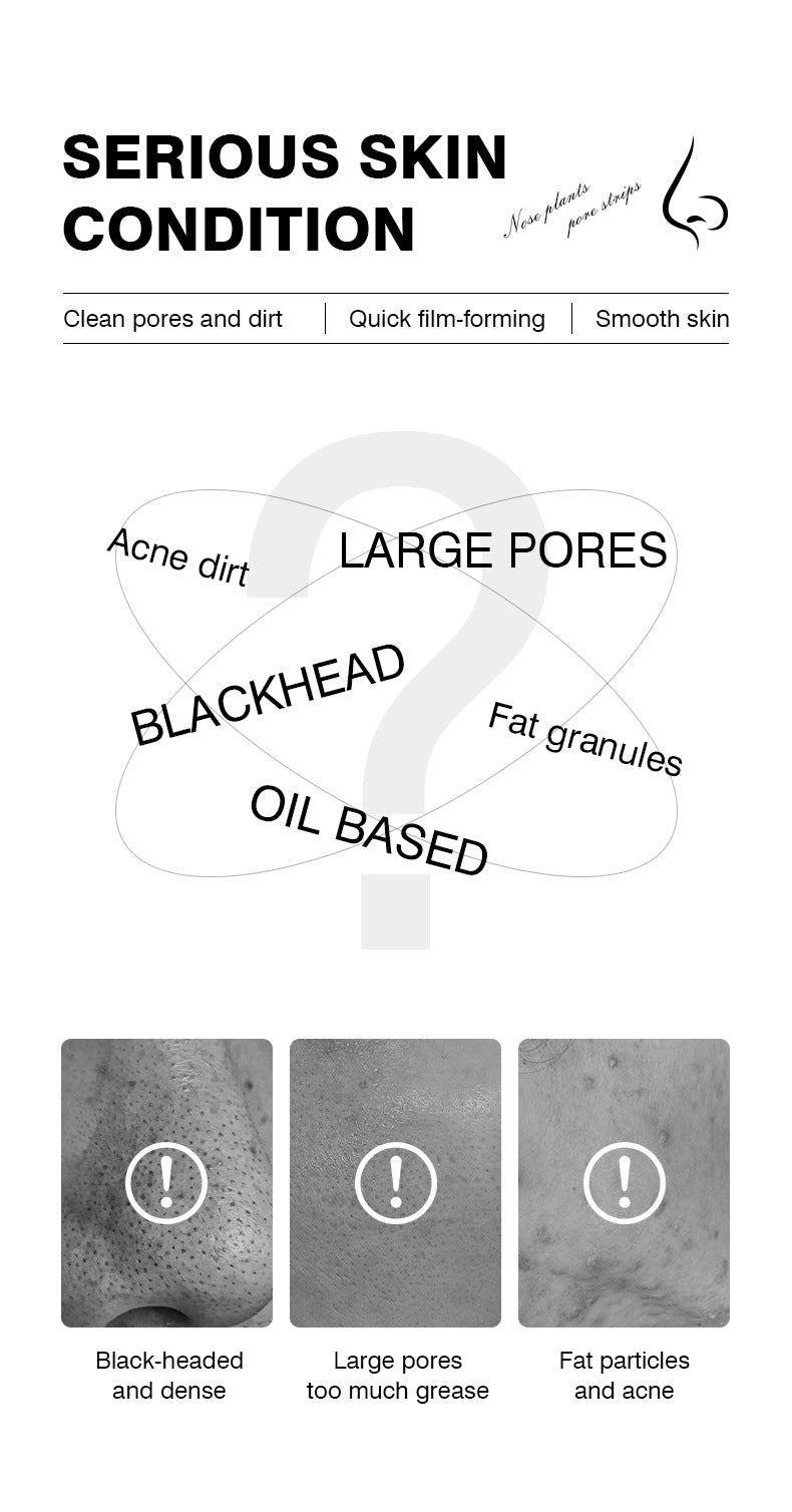 In Stock Peel-off Nose Strips Blackhead Remover Acne Cleansing Nose Mask Gentle Peel-off Pore Improvement Wholesale