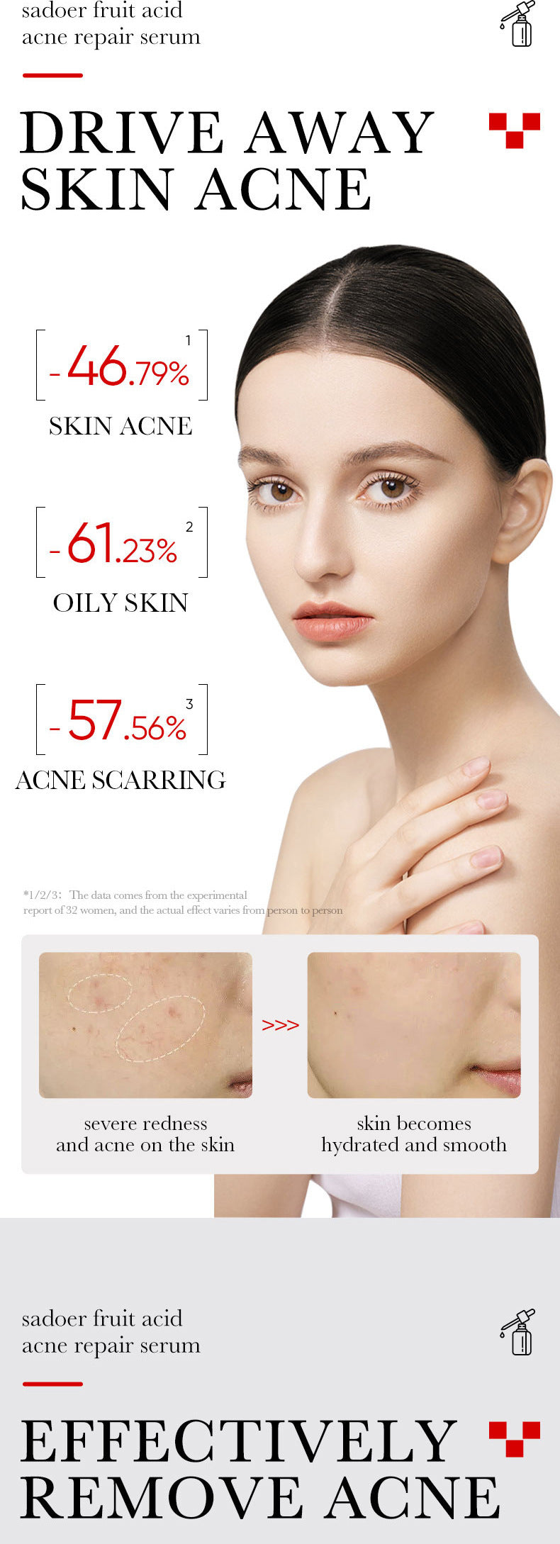 Anti-acne Serum SADOER Fruit Acid Fades Acne Marks, Hydrates and Moisturizes, Cross-Border Wholesale