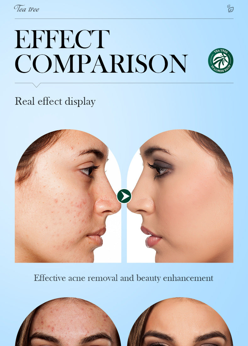 Full English Tea Tree Mousse Facial Cleanser150gSADOER Clean Bubble Dense Facial Cleanser  Wholesale