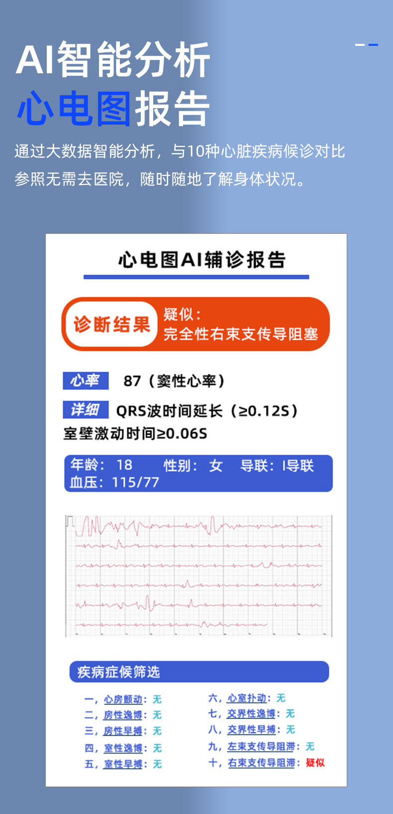 KS03Smart Watch Non-invasive Blood Glucose ECG ECG blood pressure blood oxygen temperature monitoring smartwatch manufacturer