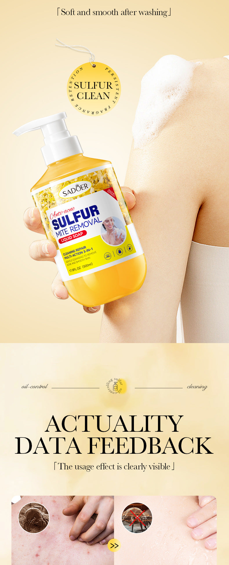 Full English Sulfur Mite Removal Body Wash SADOER Clean body hydrating moisturizing body wash  wholesale