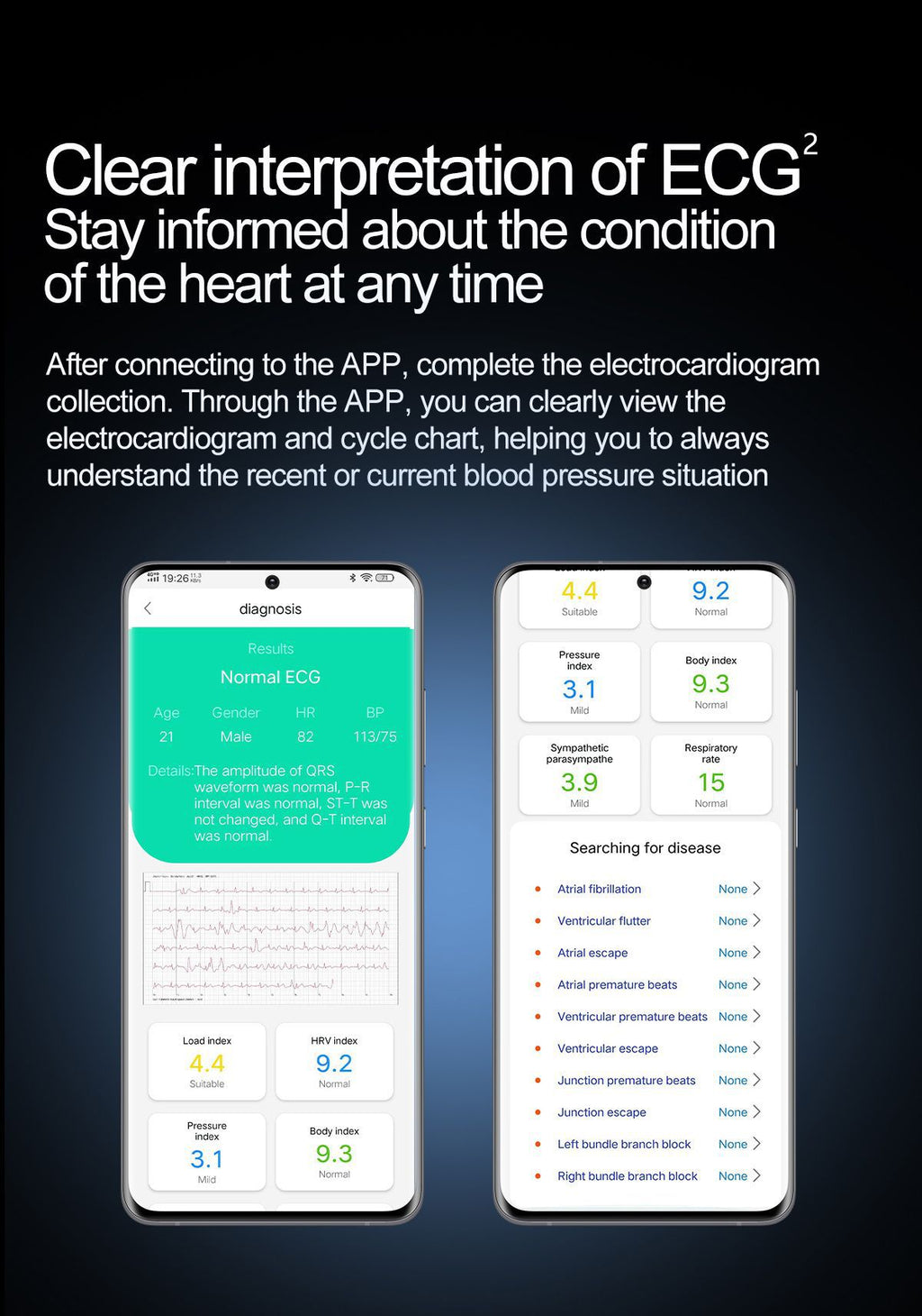 S26Air Pump Blood Pressure Smart Watch Blood Sugar Blood Oxygen Bluetooth Call Heart Rate Monitoring Air Pump Blood Pressure Watch S22