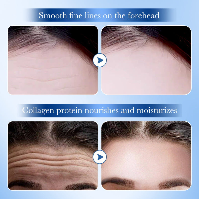 Full English Hyaluronic Acid Forehead Patch SADOER Collagen Firming Improves Forehead Wrinkles  Wholesale