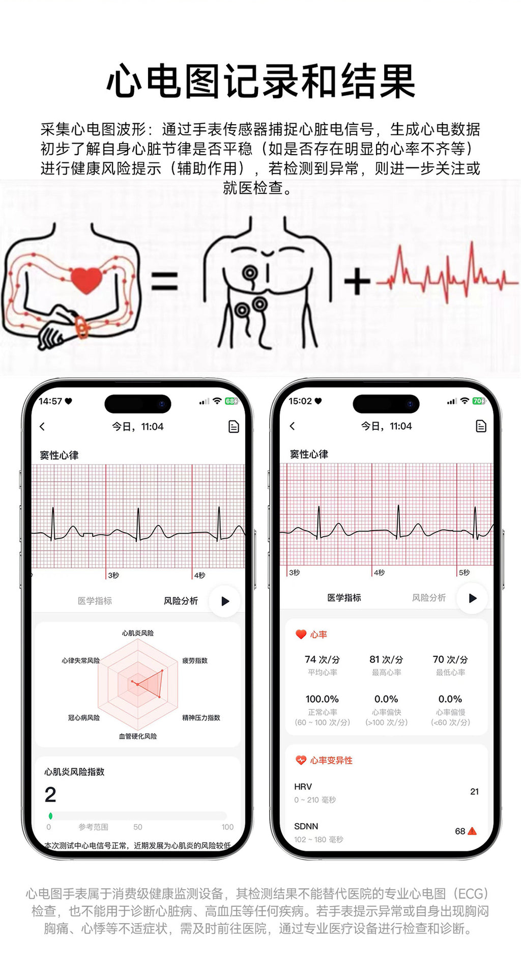 et573AI ECG Smart Health Management Watch Non-Invasive Blood Sugar Uric Acid Blood Lipid Monitoring Smart Watch