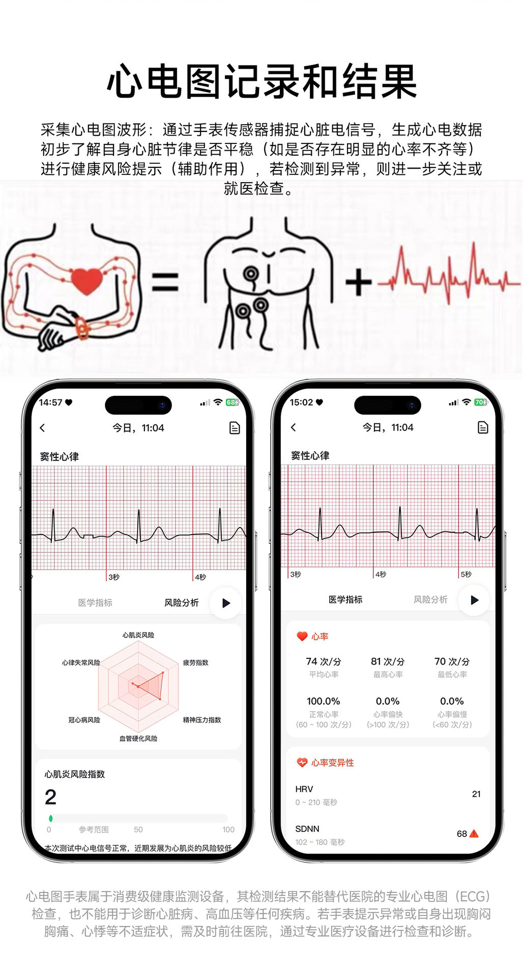 et573AI ECG Smart Health Management Watch Non-Invasive Blood Sugar Uric Acid Blood Lipid Monitoring Smart Watch