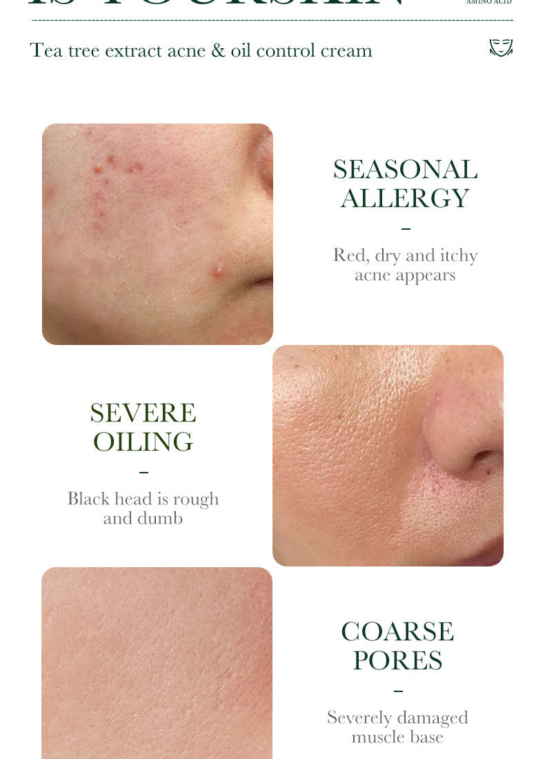 Full English Tea Tree Skincare Set SADOER Cleansing, moisturizing, hydrating five-piece set for  foreign trade wholesale