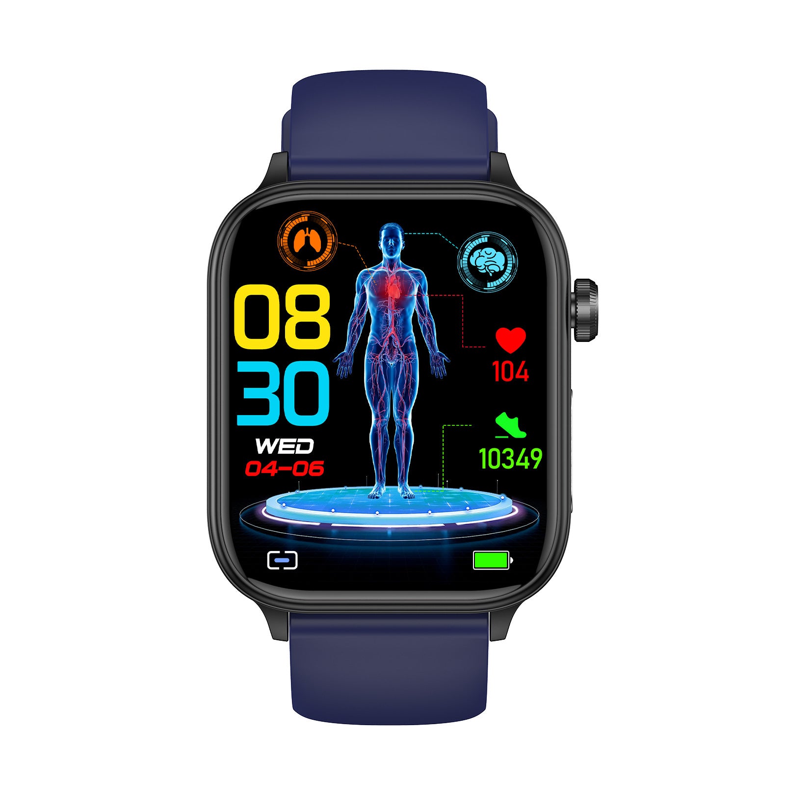 et570Smart Watch Bluetooth Calling ECG ECG function true heart rate true blood oxygen smartwatch