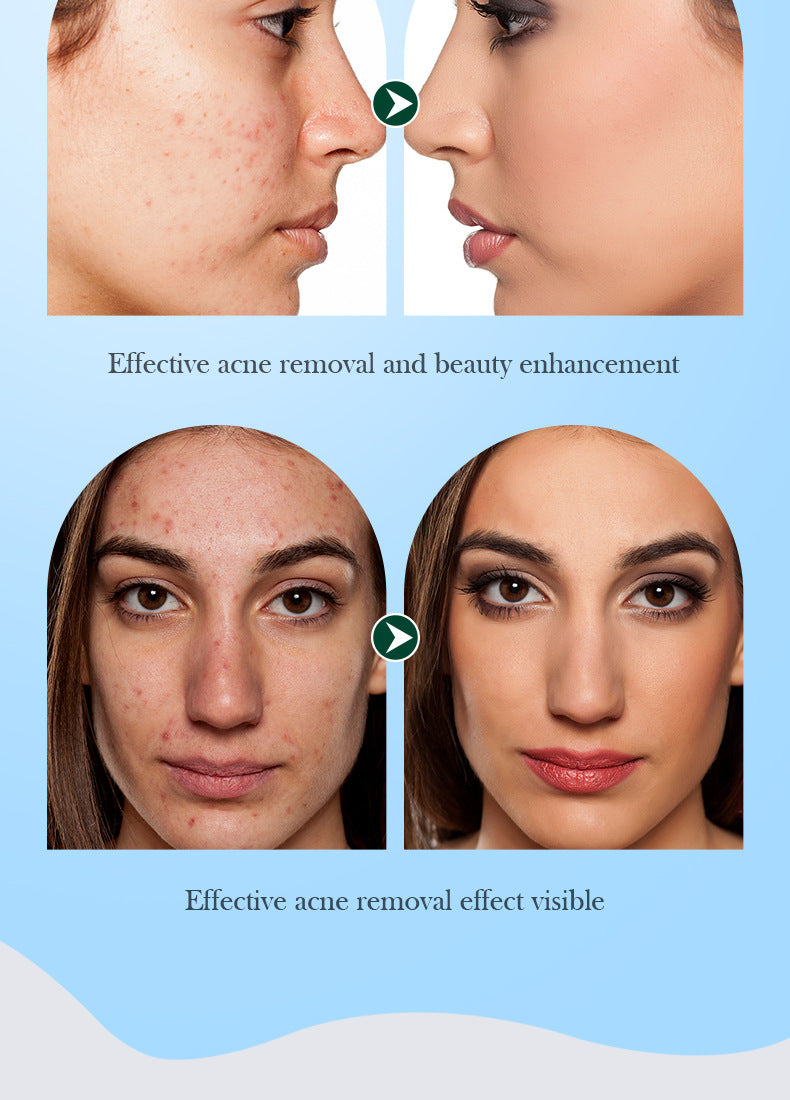 Full English Tea Tree Skincare Set SADOER Cleansing, moisturizing, hydrating five-piece set for  foreign trade wholesale