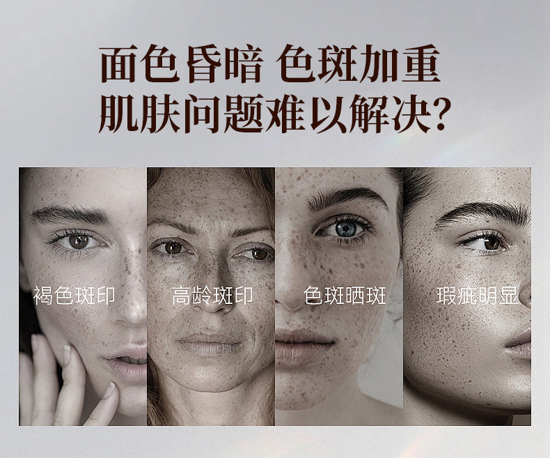 Niacinamide Whitening and Spot Removal Cream Brightening Moisturizing Fade Pigmentation Melasma Hydrating Face Cream Skincare