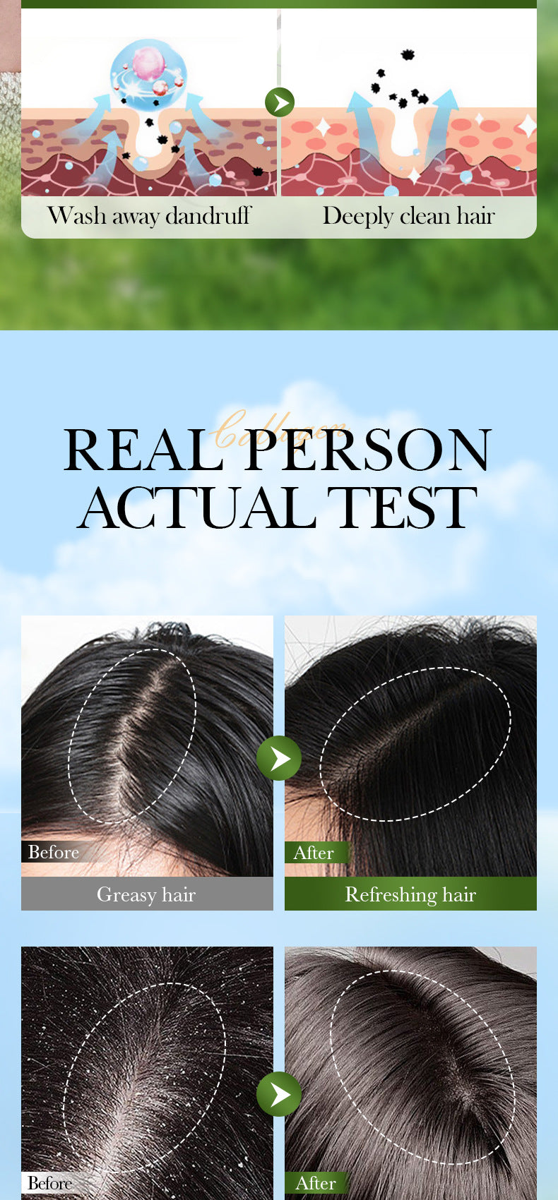 Collagen Anti-Dandruff Oil Control Shampoo SADOER Repair and Clean Shampoo Wholesale - 图片 14