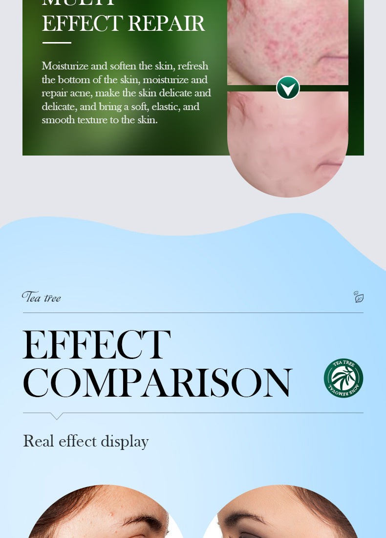 Tea Tree Essence30ml SADOER Moisturizing and refreshing cross-border foreign trade wholesale - 图片 17