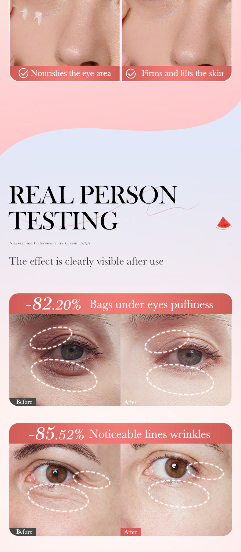 Watermelon Niacinamide Essence Eye Cream SADOER Moisturizing Eye Cream for Eye Area Wholesale Cross-Border Trade - 图片 14