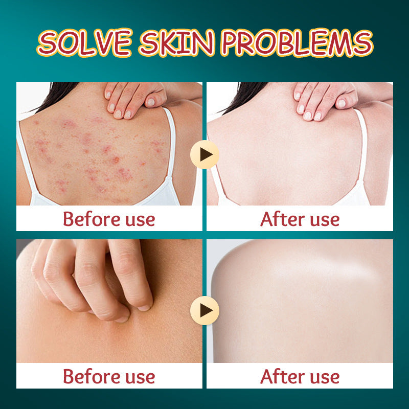 Cross-Border Christmas Stocking Bath Bombs SADOER Deep Cleansing Body Bath Bath Salts Export Manufacturer Wholesale - 图片 3