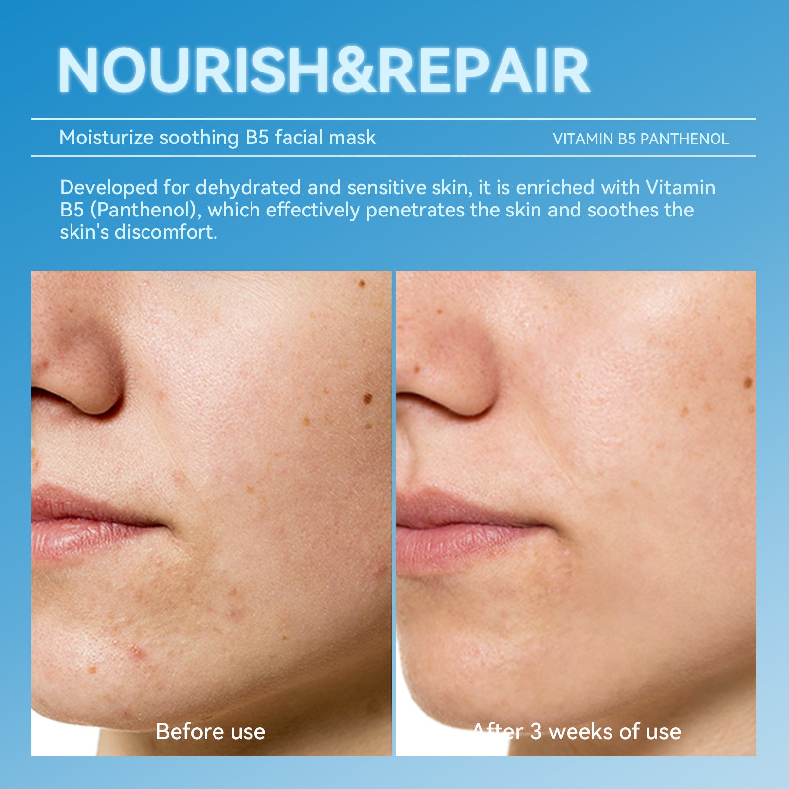 Hydrating and Soothing B5Facial Mask Hydrating Moisturizing Brightening Dullness Emergency Repair Soothing Sensitive Skin Mask Set - 图片 3