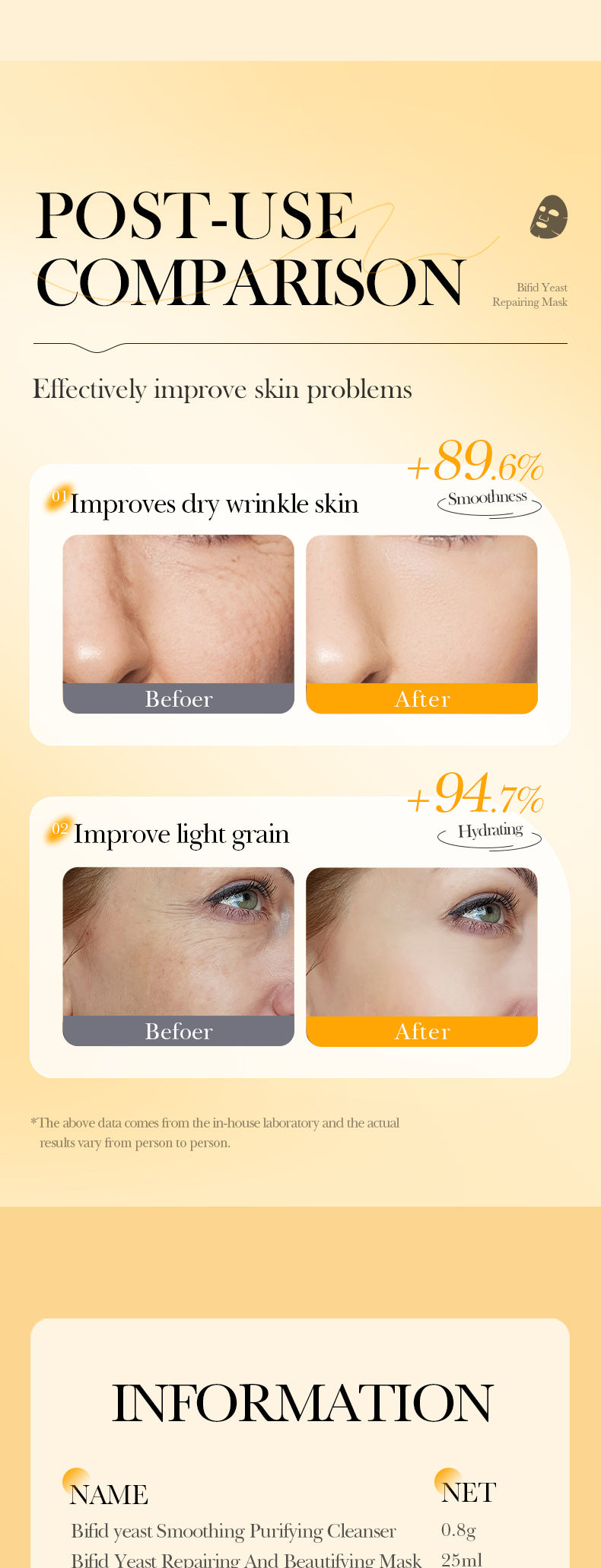 Trilogy Mask SADOER Hyaluronic Acid Firming Acne Removal Hydrating Beauty Mask Cross-Border Wholesale - 图片 23