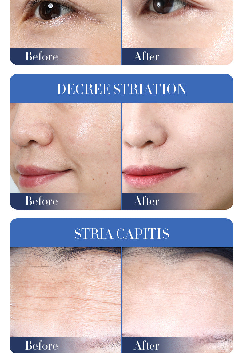 Bifid Yeast Mask30gBIOAOUA Hydrating Moisturizing Tablets for Cross-Border Wholesale - 图片 18