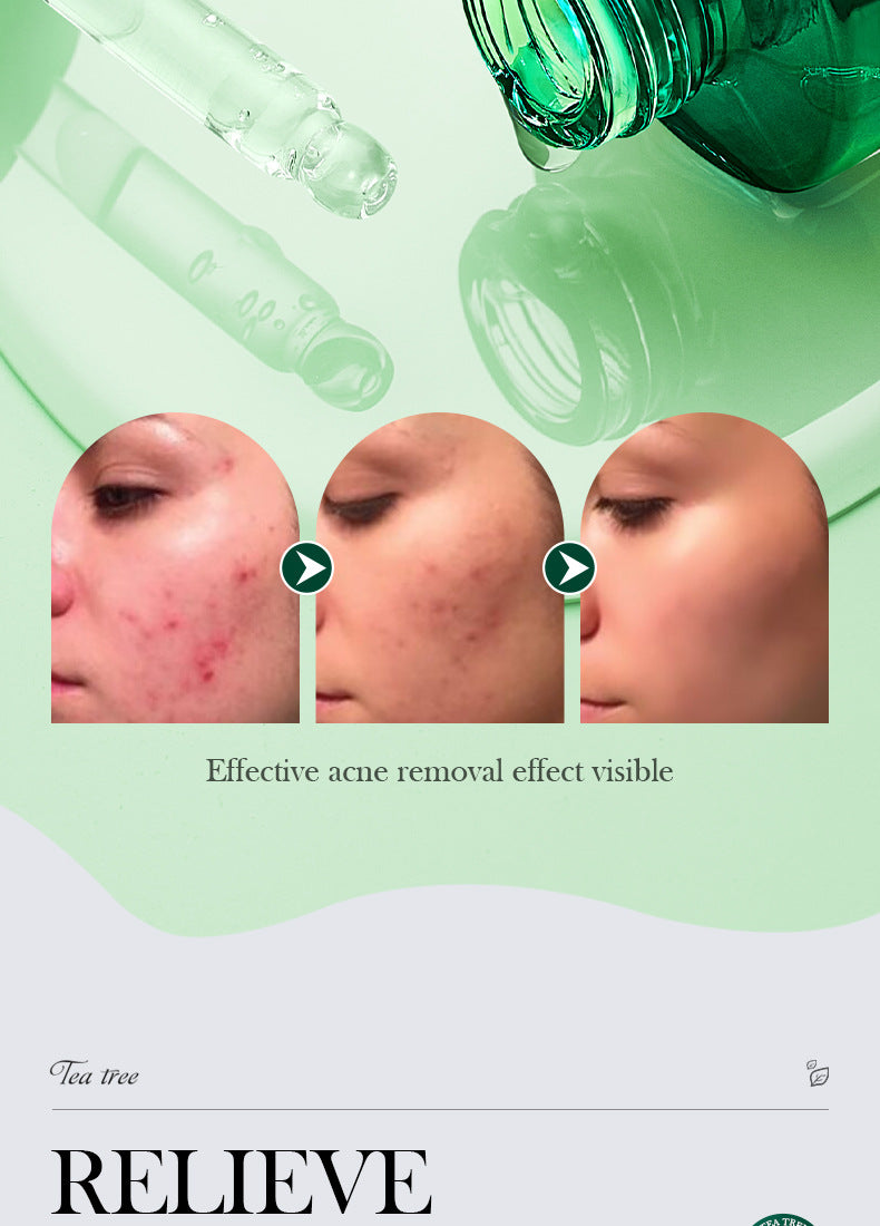 Tea Tree Essence30ml SADOER Moisturizing and refreshing cross-border foreign trade wholesale - 图片 15