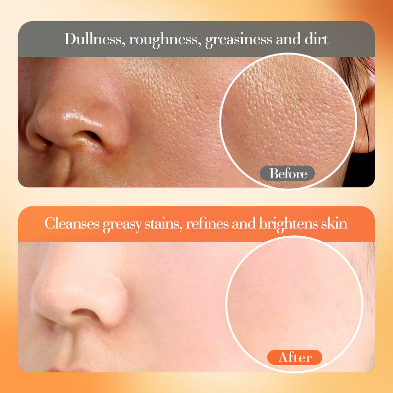 VC Whitening and Brightening Essence Lotion FAYANKOU Moisturizing lotion cross-border foreign trade wholesale - 图片 5