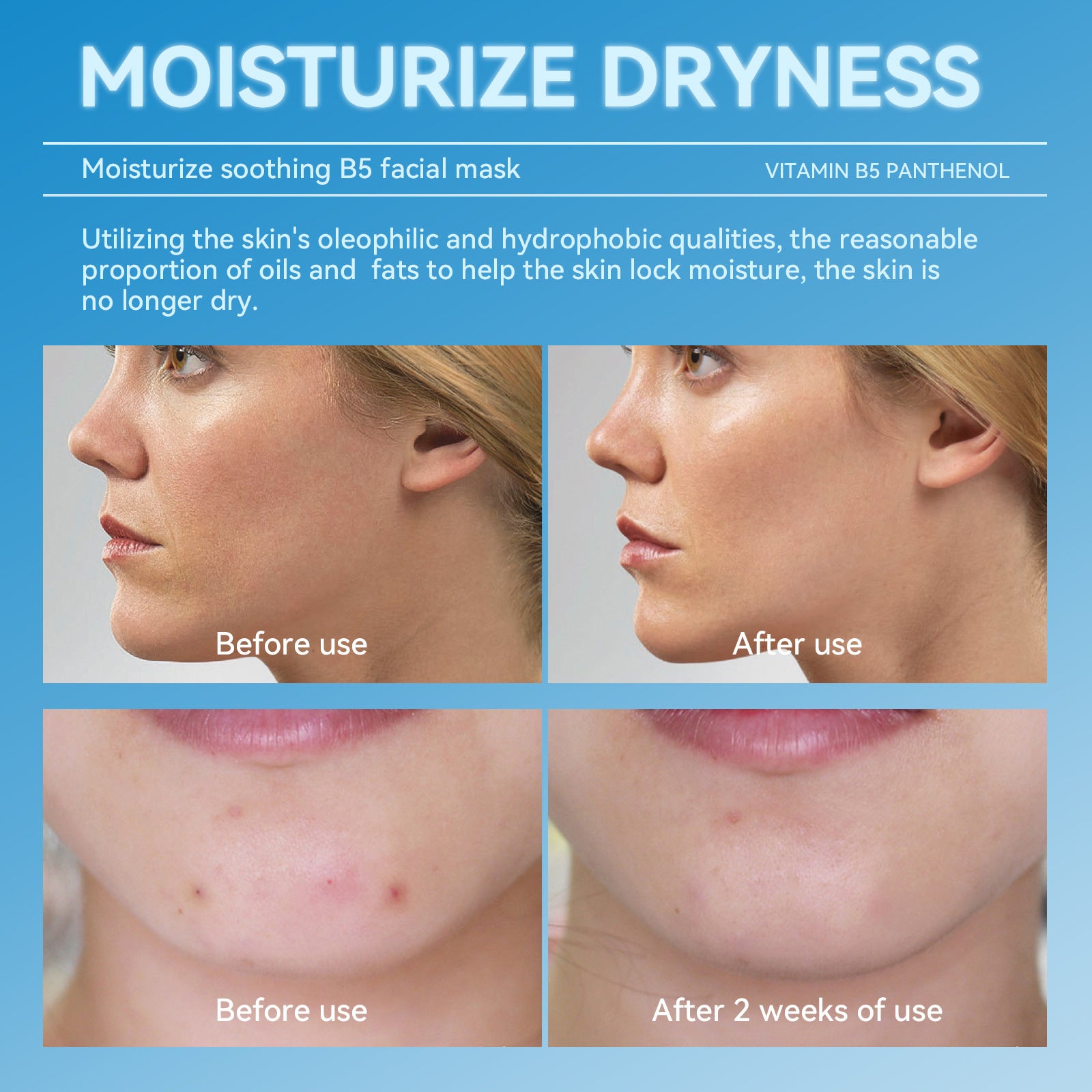 Hydrating and Soothing B5Facial Mask Hydrating Moisturizing Brightening Dullness Emergency Repair Soothing Sensitive Skin Mask Set - 图片 17