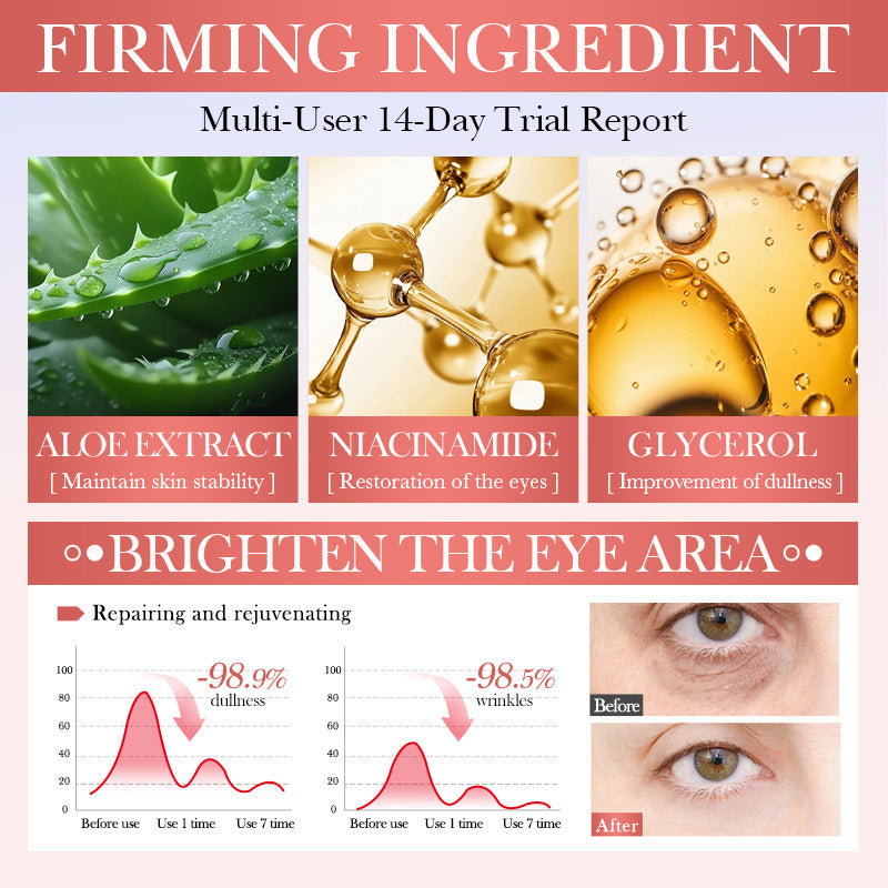 Watermelon Niacinamide Essence Eye Cream SADOER Moisturizing Eye Cream for Eye Area Wholesale Cross-Border Trade - 图片 3