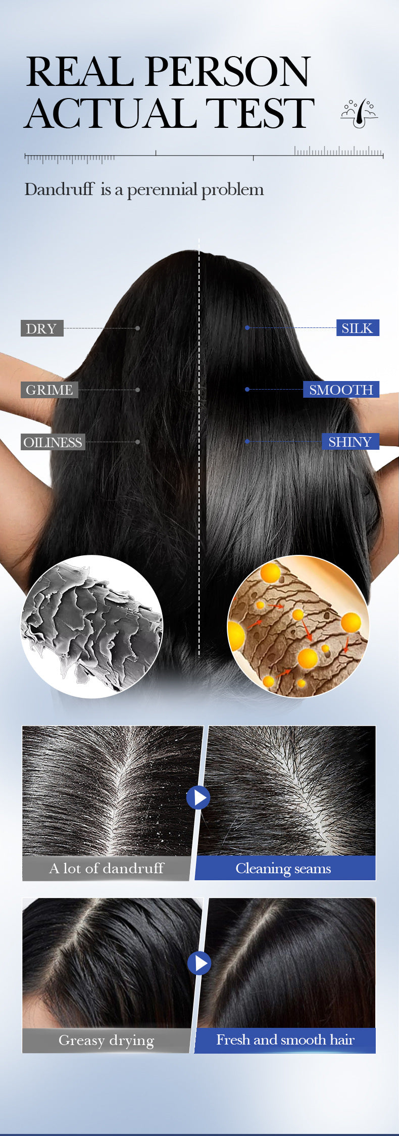 Cross-border Selenium Disulfide Anti-Dandruff Shampoo400ml Deep Cleansing and Moisturizing Shampoo Export Manufacturer Wholesale - 图片 17