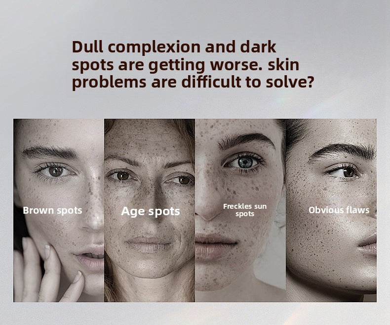 Niacinamide Whitening and Spot Removal Cream Brightening Moisturizing Fade Pigmentation Melasma Hydrating Face Cream Skincare - 图片 10