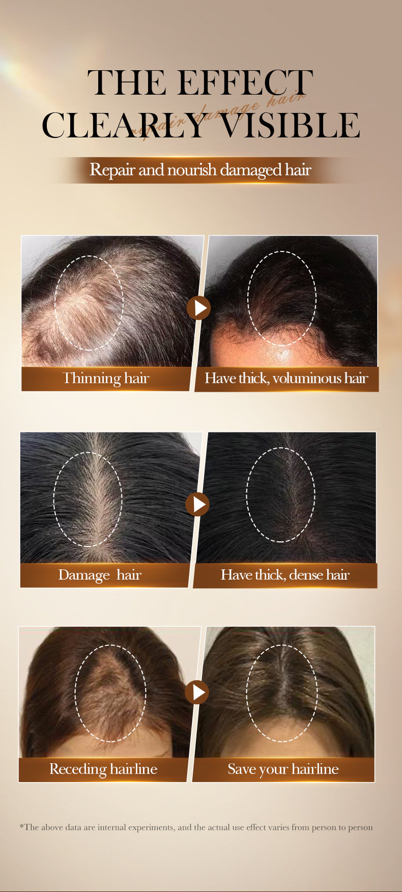 Batahana Hair Oil SADOER Scalp Soothing Smooth Conditioner Cross-Border Wholesale - 图片 17