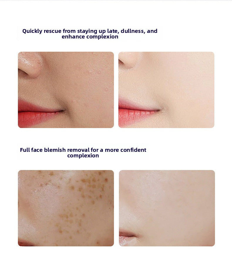 Yuejin Photon Bottle Niacinamide377Whitening and Anti-freckle Essence Facial Skin Care Moisturizing Set Brightening Skin - 图片 14