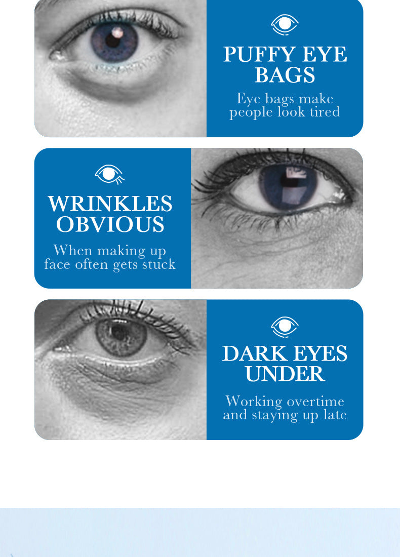 Collagen Butterfly Gel Eye Mask SADOER Improve Dark Circles and Eye Wrinkles Cross-Border Wholesale - 图片 10